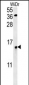 KXD1 Antibody (Center)
